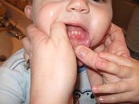 23-Kenny's_three_teeth_on_the_bottom