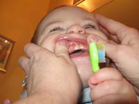 24-Kenny's_three_teeth_on_the_top
