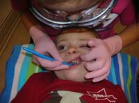51-patient_even_while_using_a_mirror