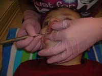 52-didn't_care_when_they_scraped_his_teeth_either