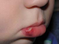 57-Kenny_bit_his_lip_badly