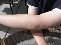 60-scratches_from_Lucas_and_Trey_at_Challenger_School_from_grabbing_Kenny