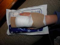 04-keep_it_on_ice_for_a_while_to_reduce_swelling