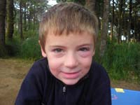 30-Kenny_woke_up_with_swollen_eye-took_some_meds_to_releave