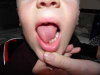 02-Kenny_shows_how_loose_his_tooth-it's_about_to_fall_out