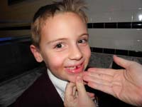 03-five_minutes_later-it_fell_out-Kenny_proud_even_though_mouth_is_bloody