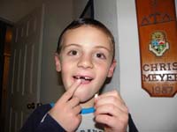 53-Kenny_lost_his_first_front_tooth-he's_happy_to_loose_the_tooth