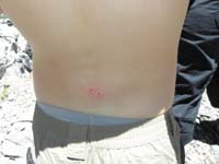 24-Kenny_fell_back_and_bruised_his_back