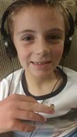 34-showing_off_his_fingernail_that_fell_off_minutes_later_when_he_broke_his_finger_last_month