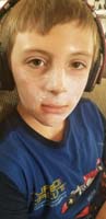 09-typical_butt_cream_regiment_since_pool_chemicals_dry_out_his_face