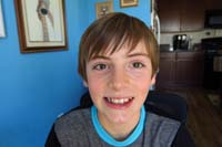 17-Kenny_needs_a_haircut,but_still_closed-smile_before_braces_installed