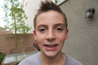 59-Kenny_has_braces_on_both_set_of_teeth_now